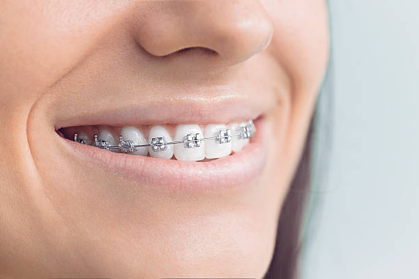 Best Traditional Braces  in Redfield, AR